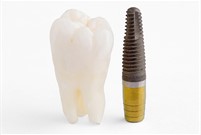 Implantati